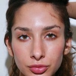 Sarah lynch vestibulum oris