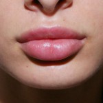 Sarah lynch vestibulum oris