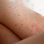 Azumi Kinoshita 木下あずみ